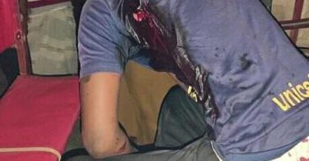 গোবিন্দগঞ্জে চালককে ছুরিকাঘাত করে ছিনতাই হওয়া অটোভ্যান উদ্ধার