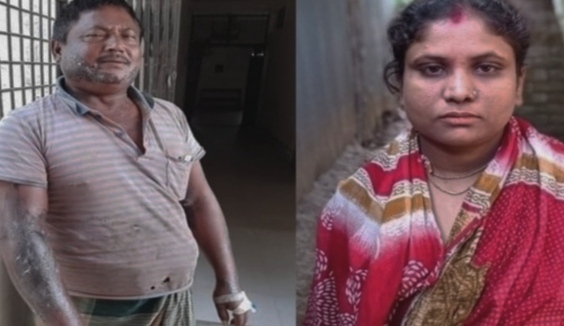 ঘোড়াঘাটে স্ত্রী ও  শ্বশুর বাড়ির লোকজনকে ফাঁসাতে নিজের শরীরে এসিড