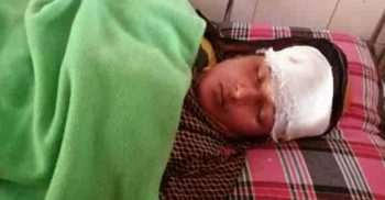 শরণখোলায় জমি-জমার বিরোধে ননদের ইটের আঘাতে ভাবী জখম