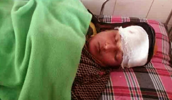 শরণখোলায় জমি-জমার বিরোধে ননদের ইটের আঘাতে ভাবী জখম