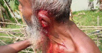 গোবিন্দগঞ্জে জমি নিয়ে বিরোধের জেরে বৃদ্ধকে কোপাল প্রতিপক্ষ