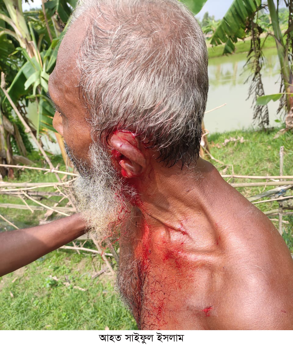 গোবিন্দগঞ্জে জমি নিয়ে বিরোধের জেরে বৃদ্ধকে কোপাল প্রতিপক্ষ