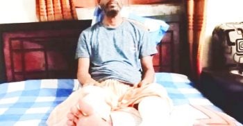 হবিগঞ্জে শ্যাওলায় পিছলে পা ভাঙল জাপা নেতার