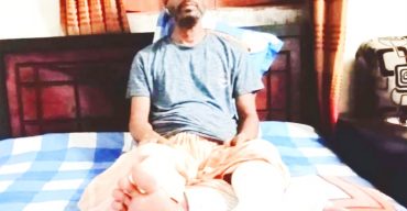 হবিগঞ্জে শ্যাওলায় পিছলে পা ভাঙল জাপা নেতার