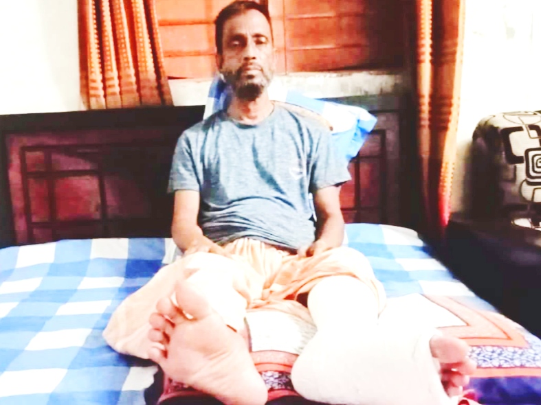 হবিগঞ্জে শ্যাওলায় পিছলে পা ভাঙল জাপা নেতার