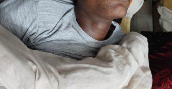 পলাশবাড়ীতে মাদকসেবীর হামলায় যুবক গুরুতর আহত