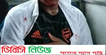 লাখাইয়ে সড়ক দুর্ঘটনায় মুখোমুখি সংঘর্ষ, আহত ৪