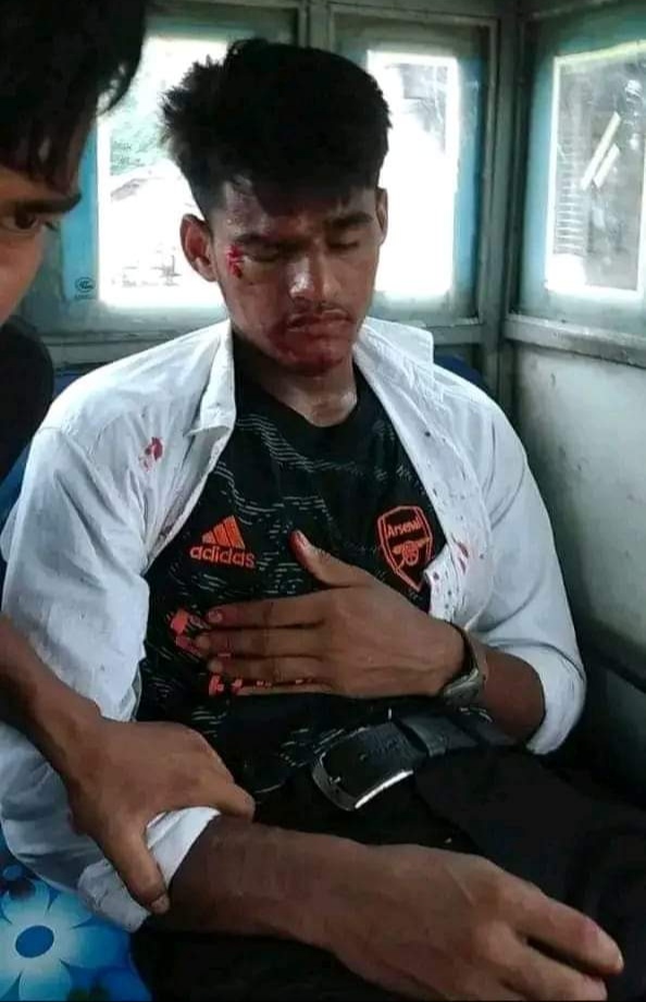 লাখাইয়ে সড়ক দুর্ঘটনায় মুখোমুখি সংঘর্ষ, আহত ৪